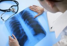 Трайно намалява броят на болните от туберкулоза в страната